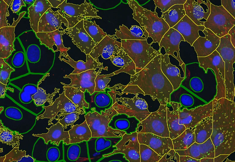 IF Cardio Cell Culture Dots